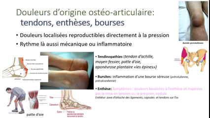 UAPod Approche Pragmatique D Une Douleur Des Membr UAPod Approche Pragmatique D Une Douleur Des Membr